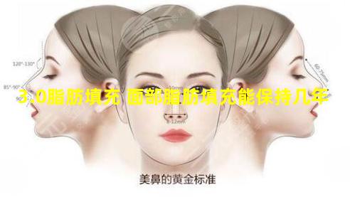 3.0脂肪填充 面部脂肪填充能保持几年